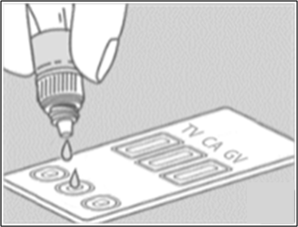 把3-4滴樣品液分別加到檢測卡的 T.V、C.A 和 G.V 樣品槽(S)上，記錄當下時間。